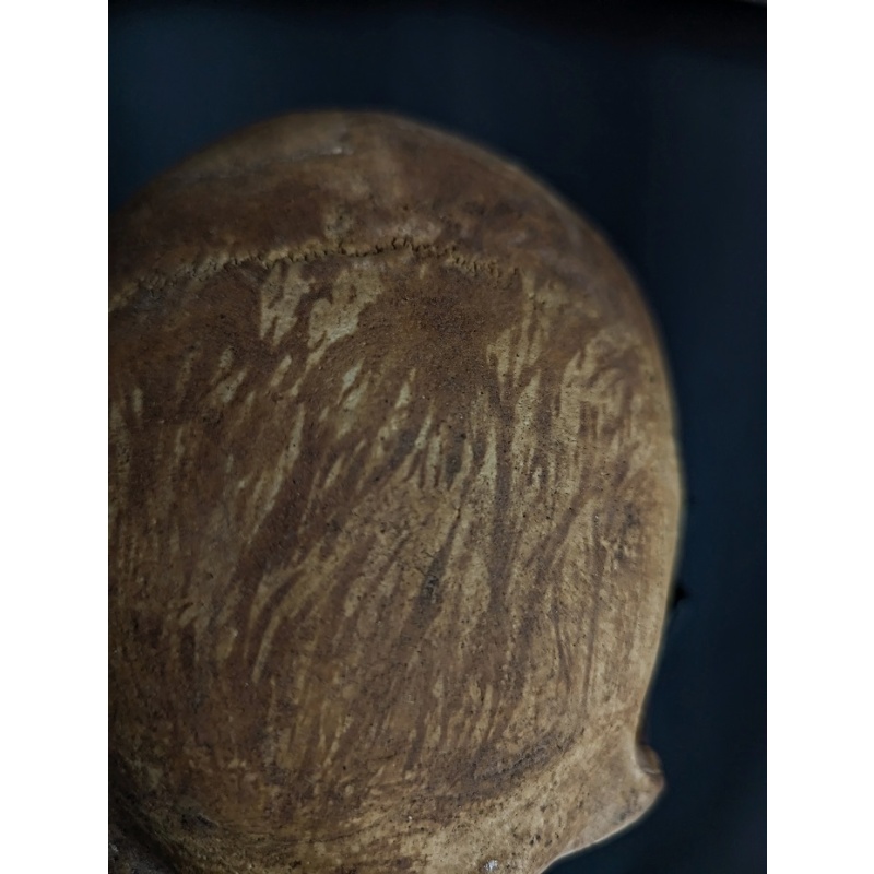 Antique Skull with trace of mummified hair 19th